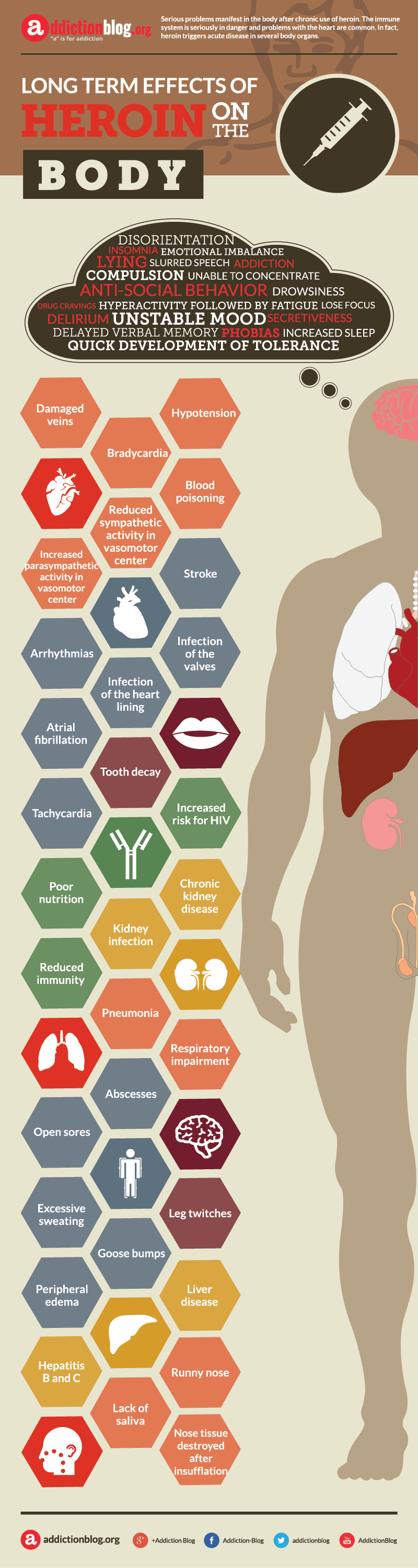 Long term effects of heroin on the body (INFOGRAPHIC)